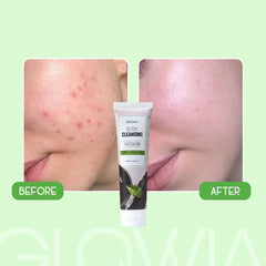 Detox Cleansing Facewash